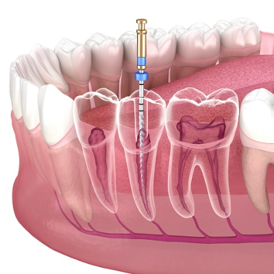 Fellowship in Endodontics