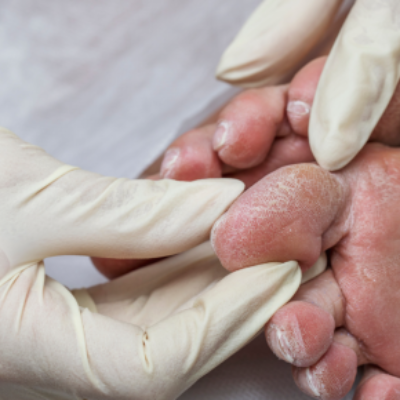 Diabetologist Course